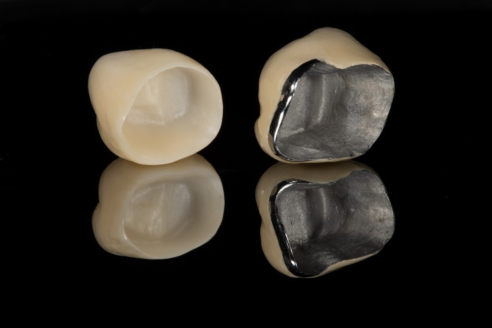 ceramic dental crown