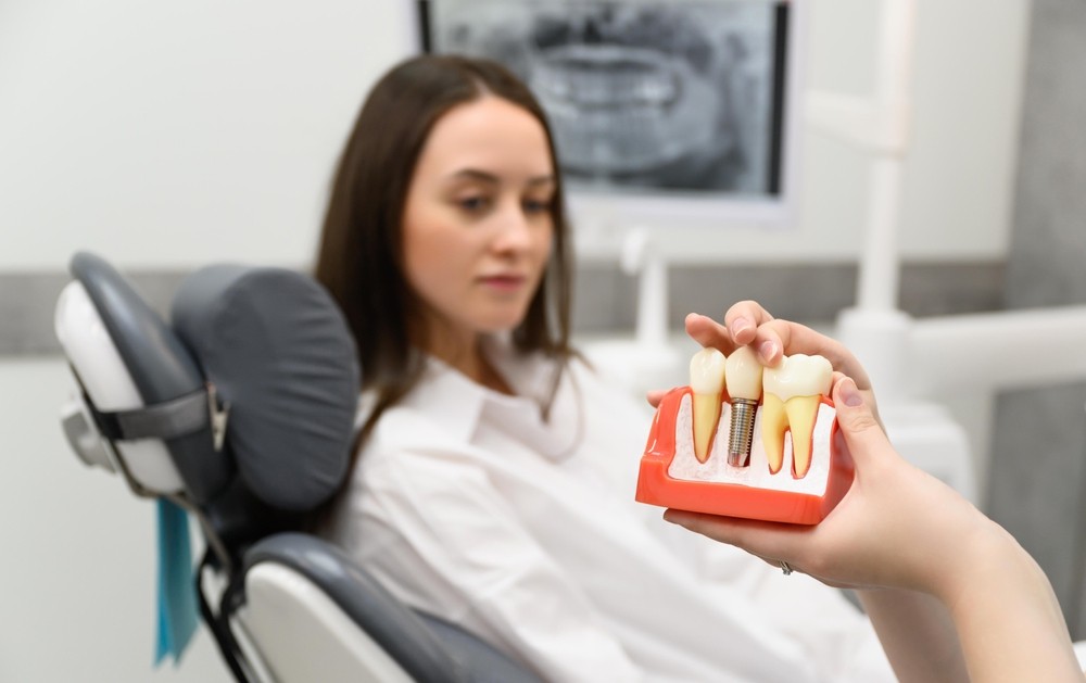 Implant Dentar